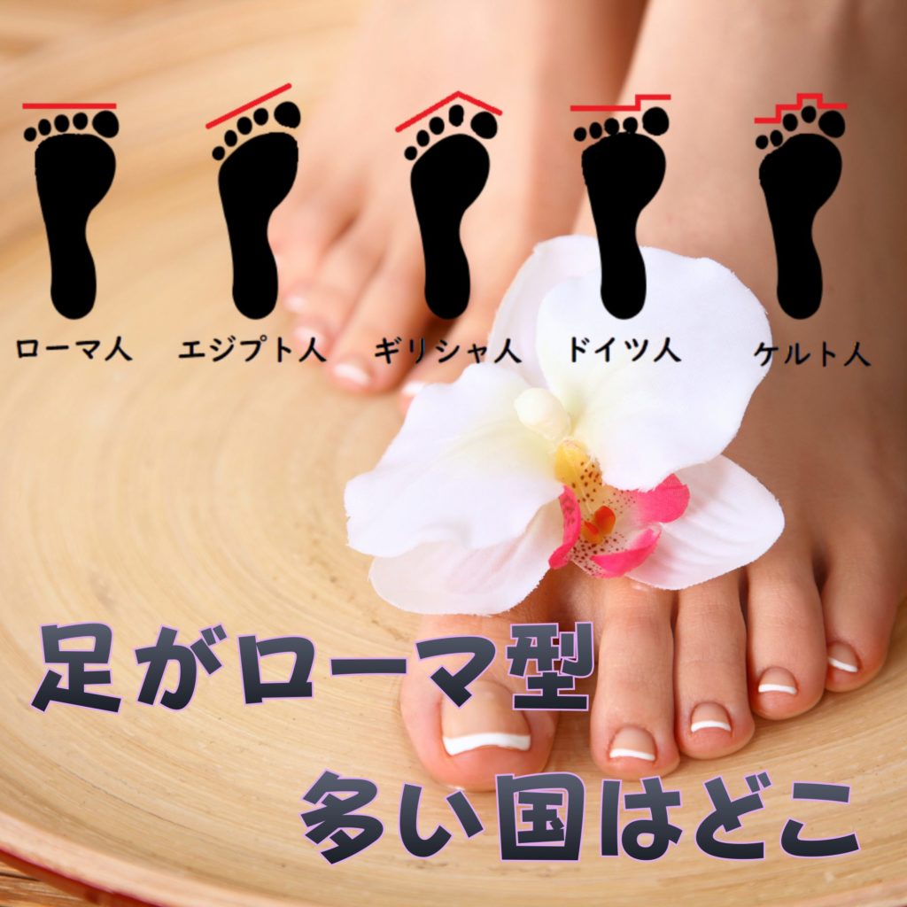足がローマ型で多い国はどこ？自分のルーツと靴選びのコツ