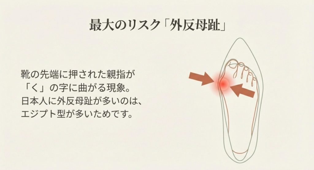 外反母趾のリスクを抑えるための解剖学的アプローチ